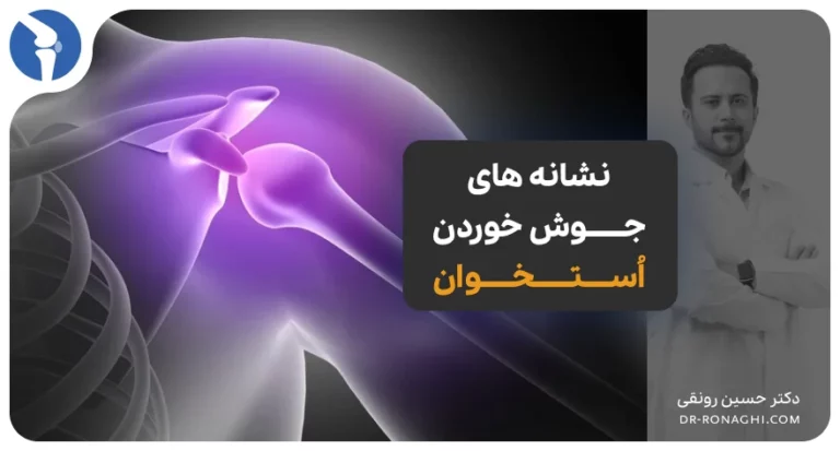 نشانه های جوش خوردن استخوان