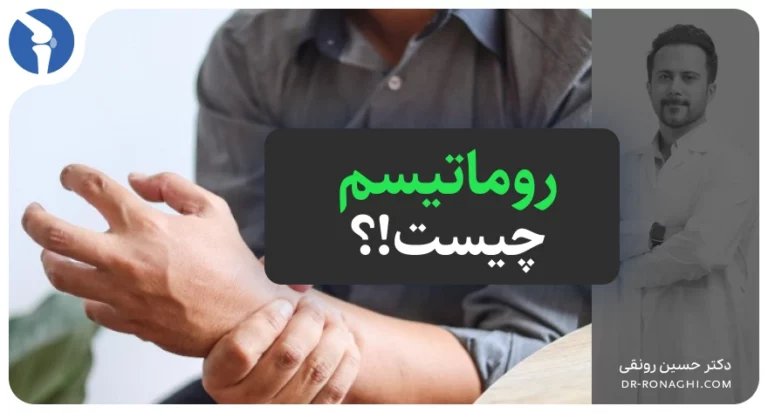 روماتیسم چیست