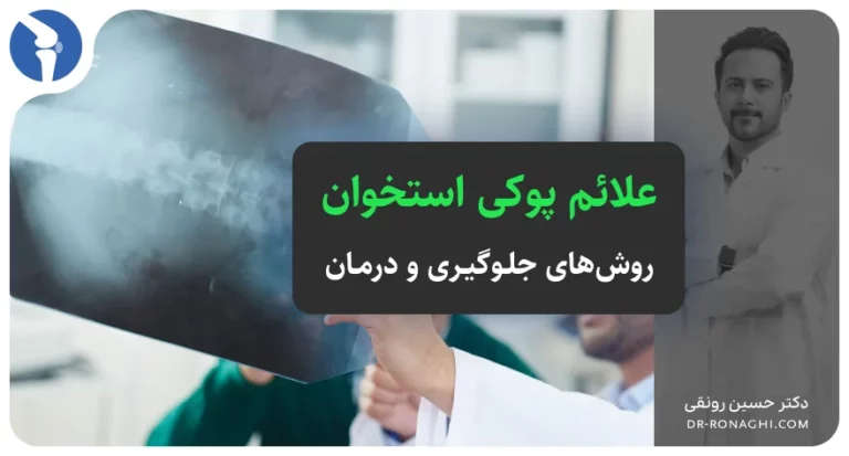 علائم پوکی استخوان چیست