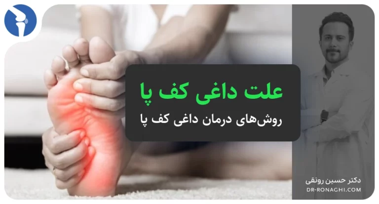 علت داغی کف پا