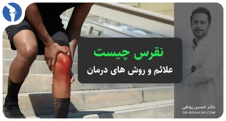 بیماری نقرص چیست و چه علائمی دارد