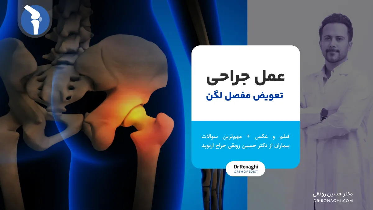 جراحی تعویض مفصل لگن [ عکس ، فیلم ، مدت زمان استراحت ]